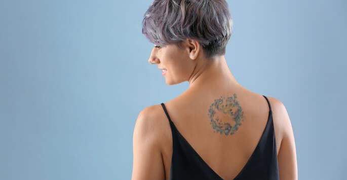 Laser Tattoo Removal in New York