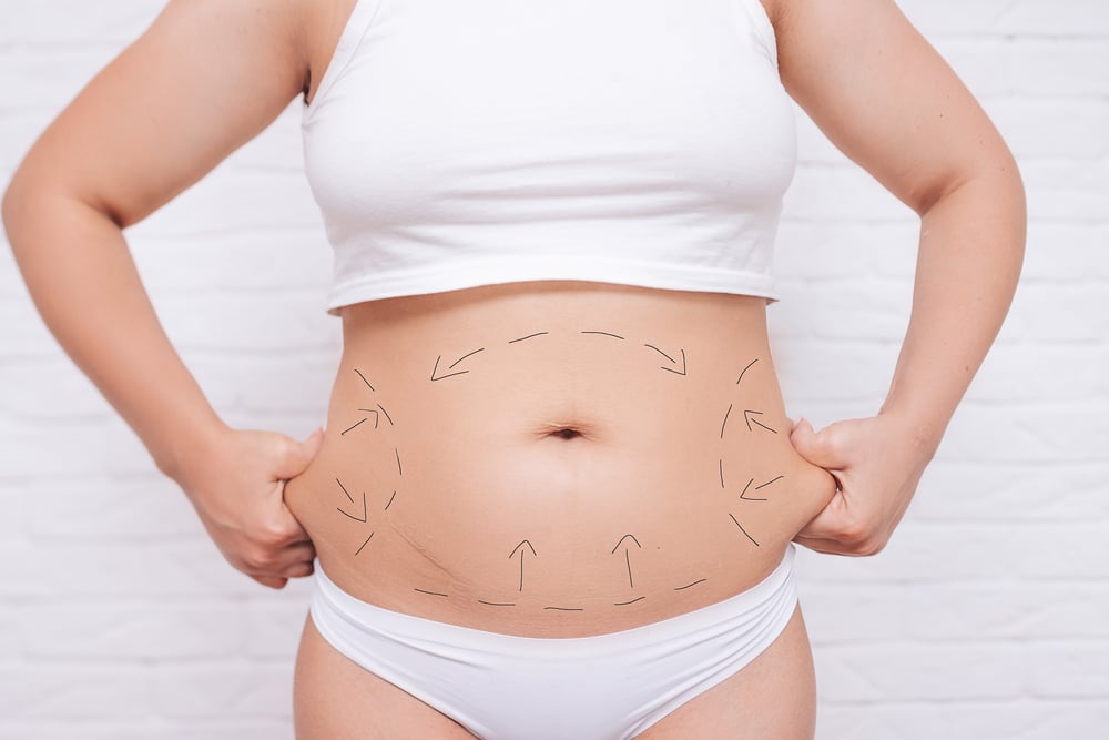 Body Contouring in Queens, NY | Metro Dermatology
